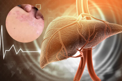 1200 675 25468430 thumbnail 16x9 liver