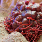 1200 675 25980307 thumbnail 16x9 bloodcancer