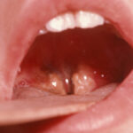 1200 675 26554170 thumbnail 16x9 pr