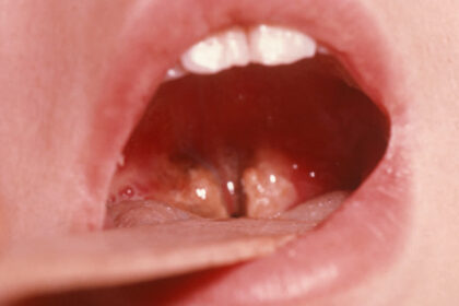 1200 675 26554170 thumbnail 16x9 pr