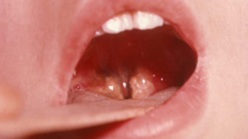 1200 675 26554170 thumbnail 16x9 pr